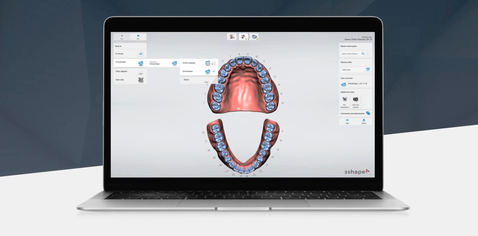 Software Orthodontic Planner 3Shape