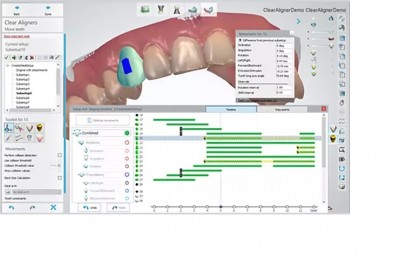 Dental System Scan Only Stand-Alone